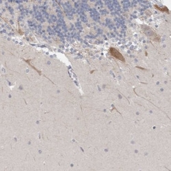 NIPA1 Antibody, Novus Biologicals 25 &mu;L, Unlabeled:Antibodies, Polyclonal